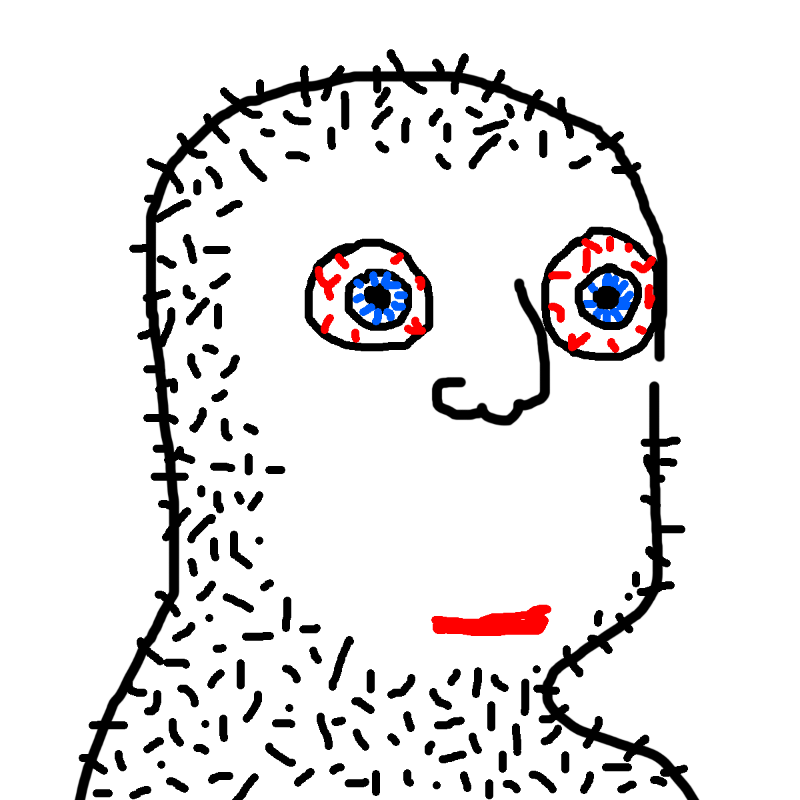 Stoopid #296