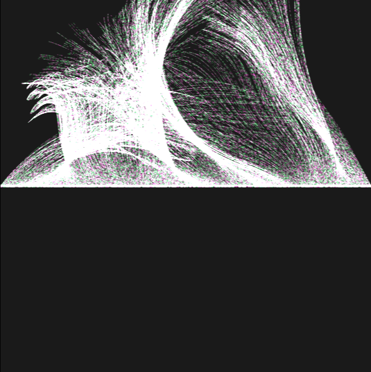 indefinite parabola #31