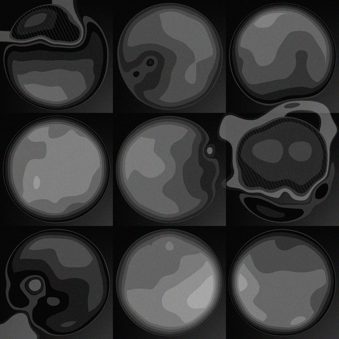 Losing My Marbles #768