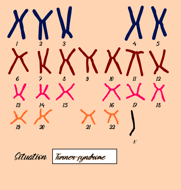 "Karyotype" #7