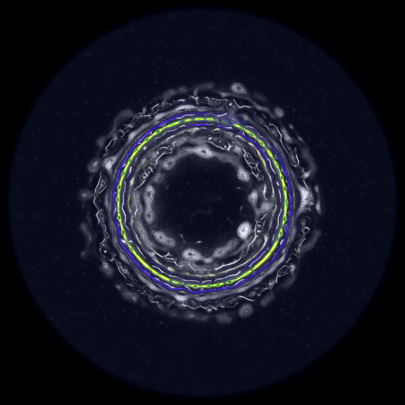 Ethereal Microcosm #187