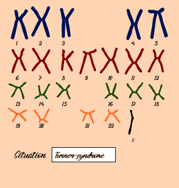 "Karyotype" #1