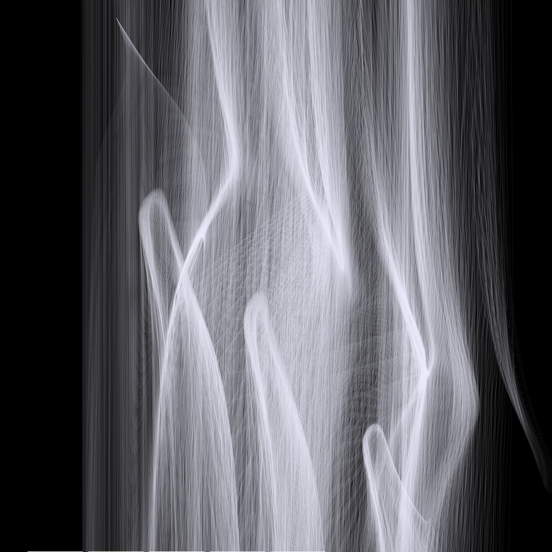 Rays of Light II #15